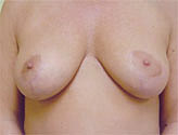Patient # 54895 After Photo # 2